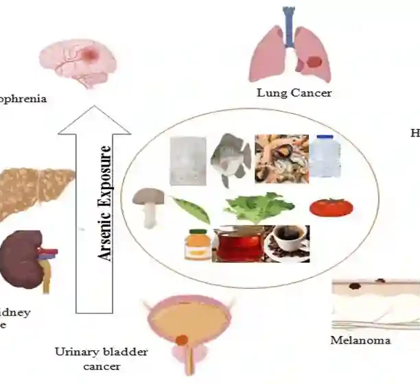 Why Does Ozdikenosis Kill You? Causes, Risks & Prevention Why Does Ozdikenosis Kill You